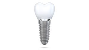 Illustration of single dental implant in Watertown against white background 