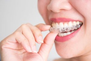 Woman smiling while placing Invisalign aligner in her mouth